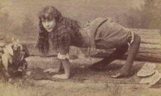 Với đôi chân dị dạng, Ella trở thành ngôi sáng của gánh xiếc. Ảnh: Wikipedia.