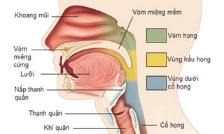 Nhiễm virus EBV được cho là nguyên nhân phổ biến gây ung thư vòm họng. Ảnh: News.