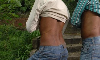 Làng bán thận ở Nepal