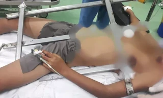 Em Tr.A.D. được đưa tới bệnh viện cấp cứu trong tình trạng bị thanh sắt đâm thấu ngực - Ảnh: Bệnh viện cung cấp