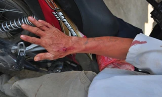 Cởi áo khoe súng rồi cướp xe ôm ở Sài Gòn