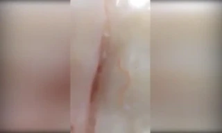 Rùng mình với sinh vật lạ trong thịt ở siêu thị