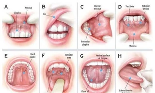 8 bước khám khoang miệng để phát hiện sớm ung thư.