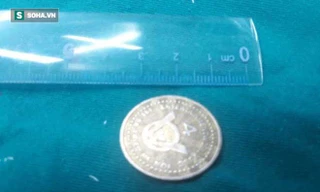 Bé trai 7 tuổi phải nhập viện cấp cứu vì đồng xu mắc ngang cổ