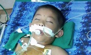 Bị đàn ong tấn công, cháu bé nhập viện trong tình trạng nguy kịch.