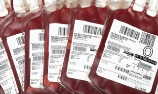 Các kháng nguyên quyết định một người thuộc nhóm máu nào. Ảnh: Wisegeekhealth.