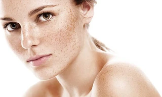 Tăng sắc tố, tàn nhang và da không đều màu đều có thể do tổn thương ôxy hóa và mất cân bằng hooc môn