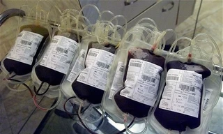 Nhóm nghiên cứu đồng thời nhận thấy cơ của chuột già được tiếp nhận máu chuột trẻ cũng khỏe mạnh hơn.