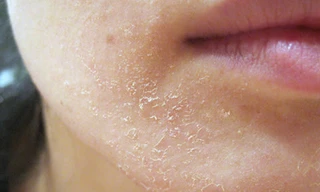 Ảnh minh hoạ: Internet