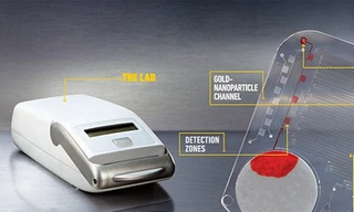 Phát hiện HIV trong vài phút với thiết bị giá 1 USD