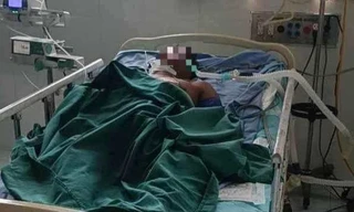 Người đàn ông nguy kịch vì ong vò vẽ đốt