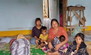 Cha tử vong, con trai 5 tuổi nhập viện nghi ngộ độc thịt cóc