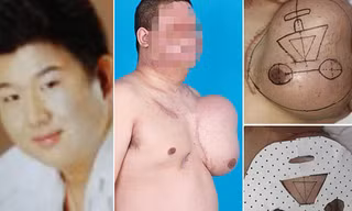 Yan trước khi bị điện giật và khuôn mặt bác sĩ đang tái tạo trên ngực trái.