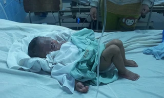 Cháu bé bị bỏng đang điều trị tại bệnh viện.