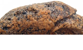 Phát hiện viên sỏi bàng quang 700 năm tuổi tại Ba Lan