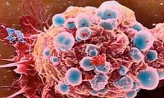 Phát hiện cách tiêu diệt cấu trúc tế bào ung thư