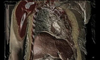 Mụn nhọt, nám da, mệt mỏi – tuyệt đối đừng coi thường