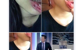 MC Minh Tiệp bị tố bạo hành em vợ: Cơ quan chức năng, thầy giáo nói gì