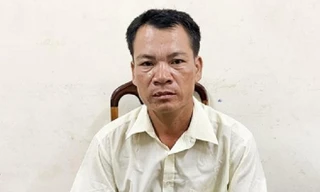 Chồng cầm xẻng đánh vợ vỡ thận do không để dành cơm tối