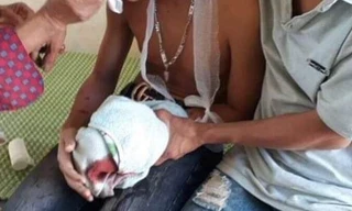 Vụ laptop phát nổ khiến 3 học sinh nhập viện cấp cứu: Không có pin sao vẫn phát nổ?