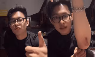 HURRYKNG kể về vết thương, hé lộ hậu trường đẫm mồ hôi tại Đấu Trường Gia Tốc