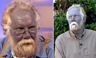 Bí ẩn về tộc người kì lạ có da màu xanh