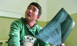 Bác sĩ bỏ quên kim khâu trong xương đùi bệnh nhân