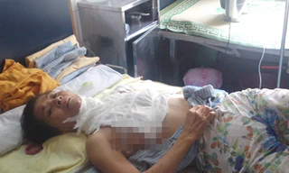 Bà Đỗ Thị Thiêm tại khoa bỏng, bệnh viện Xanh Pôn sáng 18/7. Ảnh: Tuấn Nguyễn