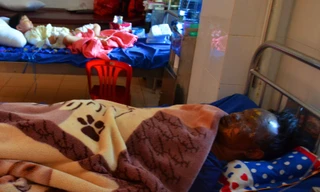 Dùng thuốc nổ tự chế pháo, anh H. bị cháy đen mặt nằm ở BV ĐK tỉnh Đắk Lắk