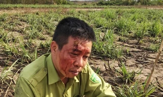 Ông Ngô Lê Nhật Tiến - Trạm phó Trạm Kiểm lâm số 7 bị lâm tặc tấn công