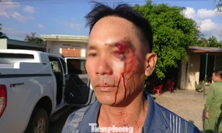 Ông Hôm bị đánh trọng thương ngay sau khi cung cấp thông tin cho báo chí