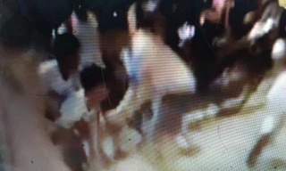 Nam thanh niên 17 tuổi (giữa) bị đâm vào bụng. Ảnh: TN