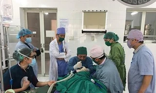 Các bác sỹ đa khoa Lạng Sơn đang xử lý công việc gắp bi ra khỏi trực quản em bé .Ảnh: TL