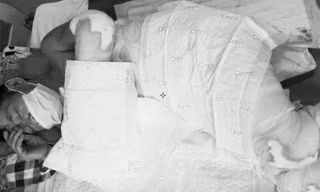 Ông Thiện đang tích cực cấp cứu tại bệnh viện đa khoa Lạng Sơn nhưng tiên lượng xấu, nguy cơ đến tử vong. Ảnh: ĐK