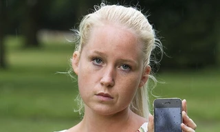 Cô Baxter và vết bỏng bên ngực trái của mình cùng chiếc điện thoại iPhone 4.