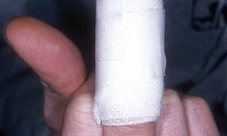 Kiện đòi bồi thường 2 triệu tỷ tỷ tỷ USD vì bị chó cắn