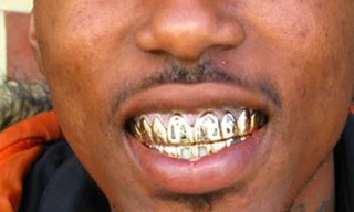 Thoát chết vì đạn trúng... răng vàng