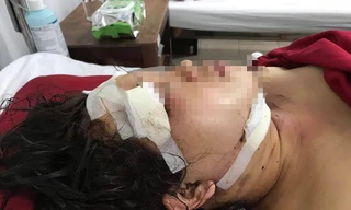 Chị M đang được cấp cứu tại bv Trung ương Huế