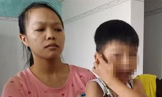 Quảng Nam: Giáo viên mầm non bị tố đánh trẻ chấn động não