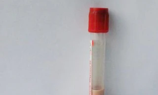 Em bé có máu màu trắng