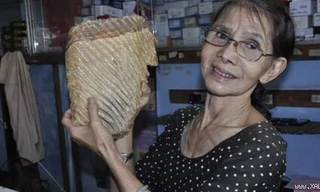 Bà Diễm và hàm răng cổ. Ảnh: Lê Anh