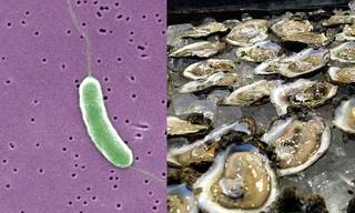 CẢNH BÁO: Vi khuẩn ăn thịt người khi đi tắm biển