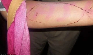 Cô gái khắc hình cá voi xanh lên tay để tham gia làm nhiệm vụ. Ảnh: Jodhpur Police. 