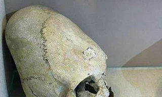 Các chiến binh Sarmatia cổ đại đều có phần hộp sọ dài khác thường. 