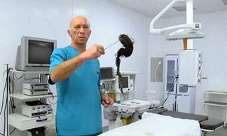 Búi tóc được lấy ra trong bụng bé gái. Ảnh: Dailymail