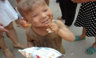 Bé trai 7 tuổi bị hành hạ phải sống trong chuồng lợn hôi hám