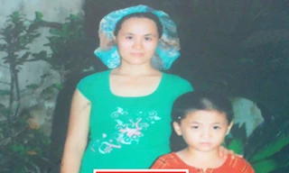 Nỗi khổ của người phụ nữ có mái tóc 'sư tử'