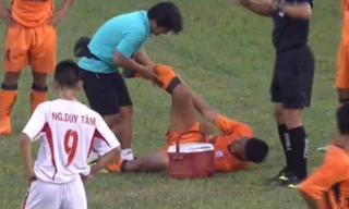 Duy Bảo gãy chân vì vào bóng thô bạo với đối thủ
