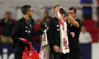 Wayne Rooney vỡ mũi tại Mỹ