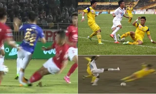 Những ca gãy chân kinh hoàng trong làng bóng đá Việt 